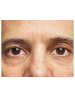 Clinique All About Eyes Brightening Concentrate Serum