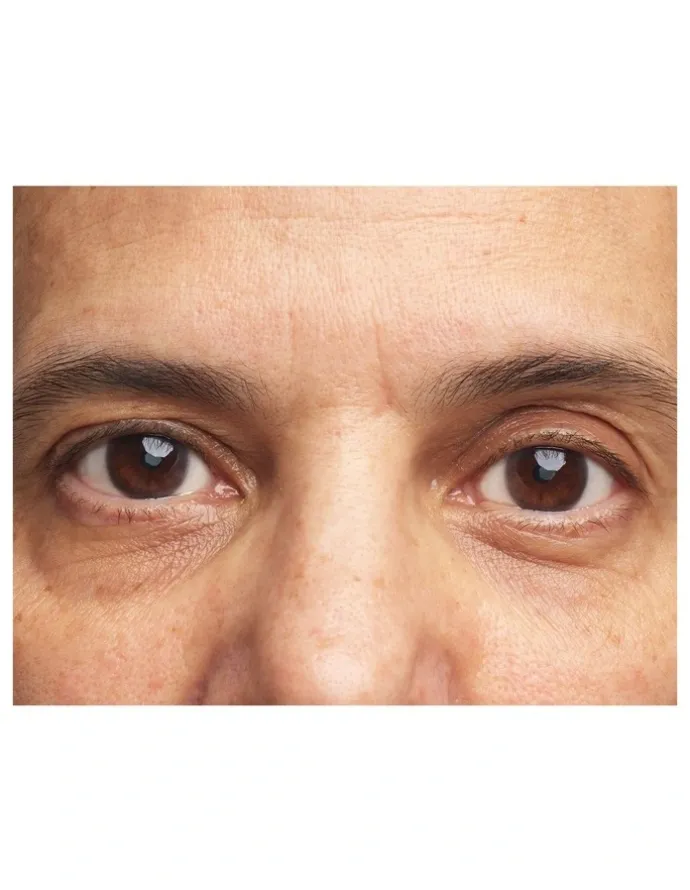 Clinique All About Eyes Brightening Concentrate Serum