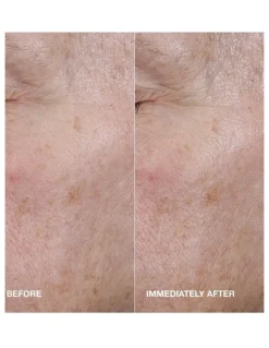 Clinique Moisture Surge Active Glow Serum