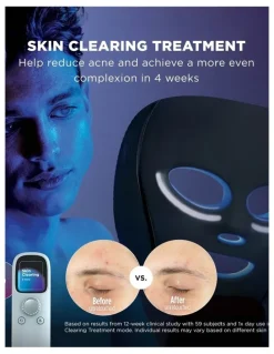 Shark CryoGlow Cooling + LED Face Mask FW312ANZ