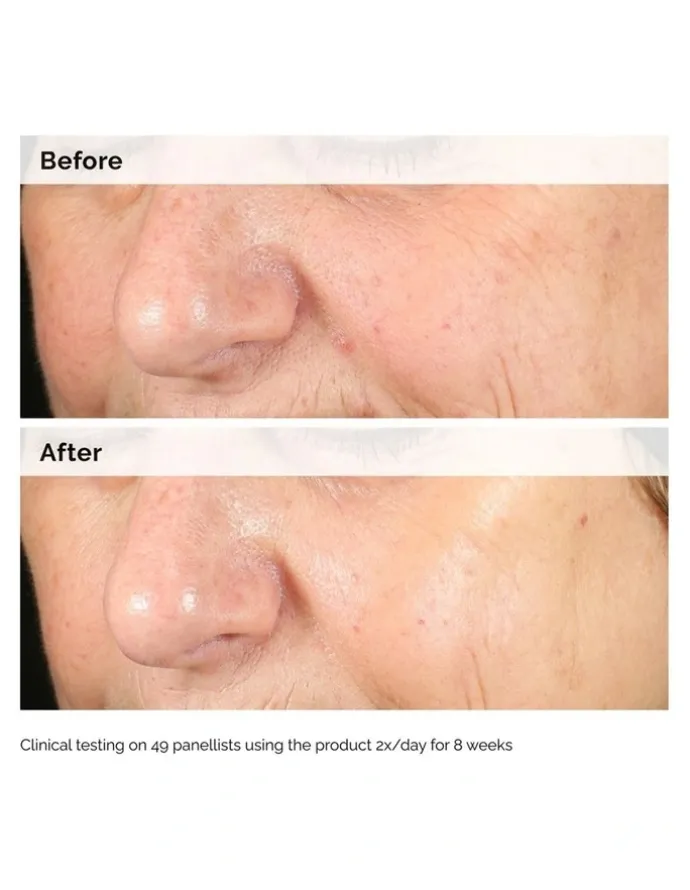 The Ordinary Alpha Arbutin 2% Hyaluronic Acid for Brightening and Dark Spots 30ml
