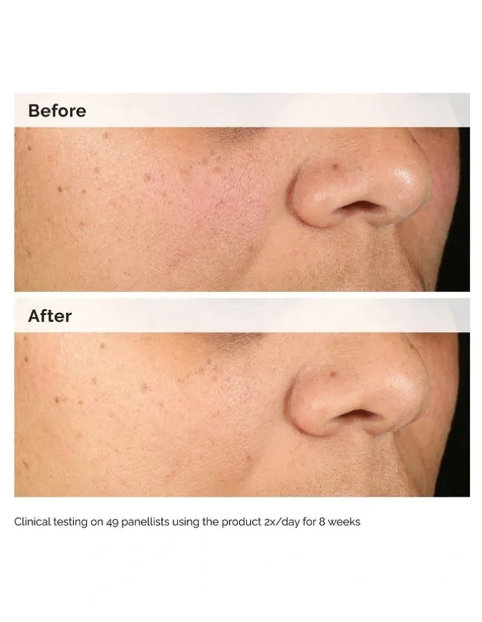 The Ordinary Alpha Arbutin 2% Hyaluronic Acid for Brightening and Dark Spots 30ml