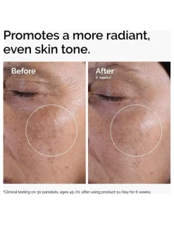 The Ordinary Glycolic Acid 7% Exfoliating Toner for Brightening and Smoothing 240ml