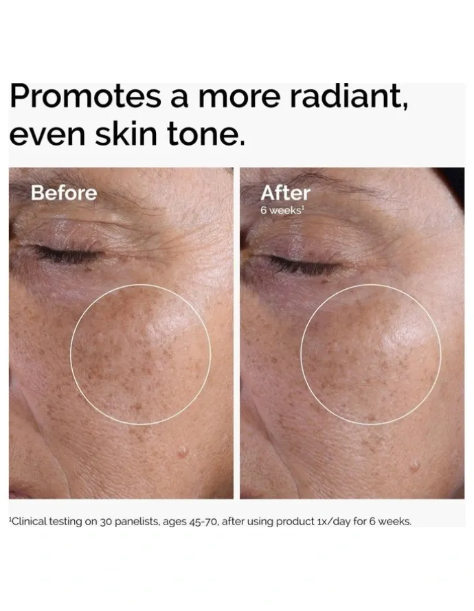 The Ordinary Glycolic Acid 7% Exfoliating Toner for Brightening and Smoothing 240ml