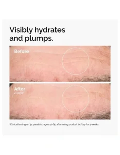 The Ordinary Hyaluronic Acid 2% + B5 Hydrating Serum with Ceramides