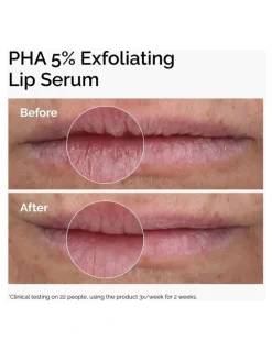 The Ordinary PHA 5% Lip Exfoliating Sreum