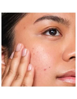 The Ordinary Salicylic Acid 2% Anhydrous Solution, Gentle Exfoliating Serum for Blemish-Prone Skin 30ml