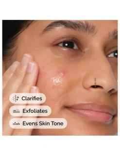 The Ordinary Salicylic Acid 2% Anhydrous Solution, Gentle Exfoliating Serum for Blemish-Prone Skin 30ml