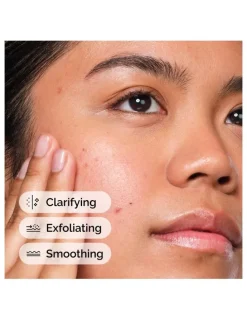 The Ordinary Salicylic Acid 2% Solution, Exfoliating Serum for Blemish-Prone Skin 30ml
