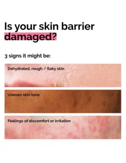 The Ordinary Soothing & Barrier Support Serum for Sensitive Skin, Hydration, Redness, Barrier Repair 30ml