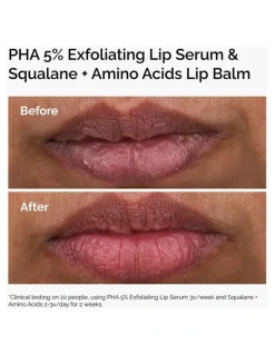 The Ordinary Squalane + Amino Acids Hydrating Lip Balm for Lips, Elbows and Cuticles 15ml