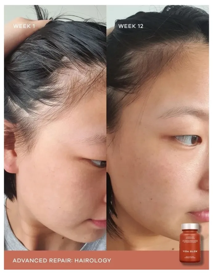 Vida Glow Hairology Supplement