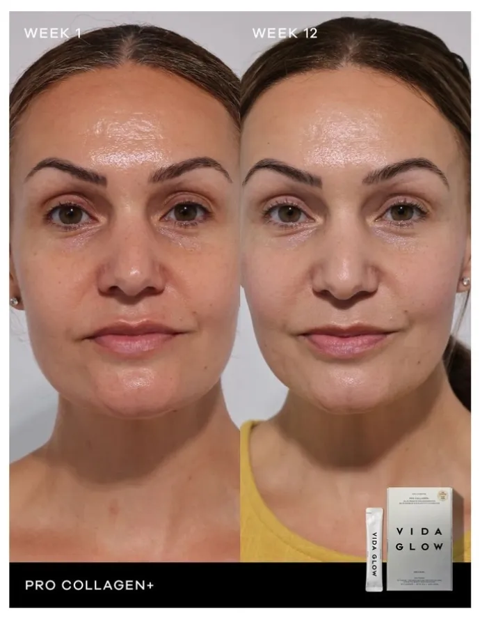 Vida Glow Pro Collagen +