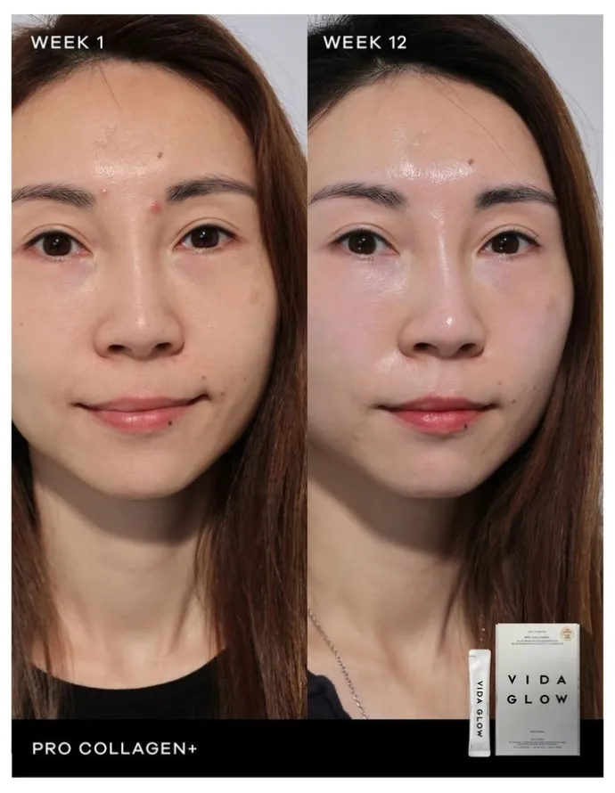 Vida Glow Pro Collagen +