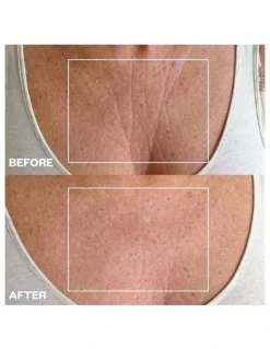 Wrinkles Schminkles Chest Wrinkle Patch - 1 Patch