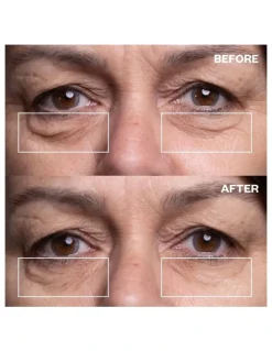 Wrinkles Schminkles Eye Wrinkle Patches - 3 Pairs of Patches